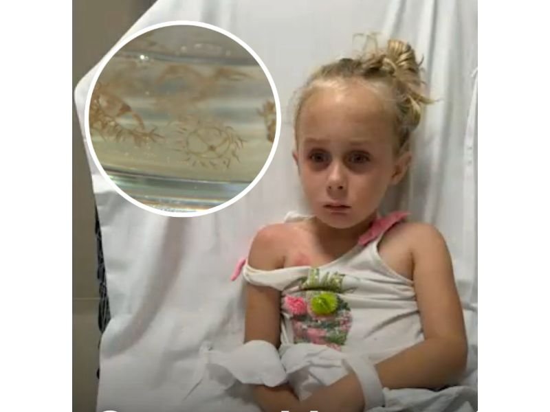 6-Year-Old Endures Days of Agony After Rare Clinging Jellyfish Sting in NJ River