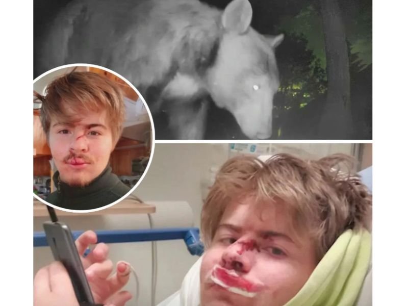 California Teen Suffers Severe Facial Injuries After Bear Enters Home and Attacks Him While Sleeping